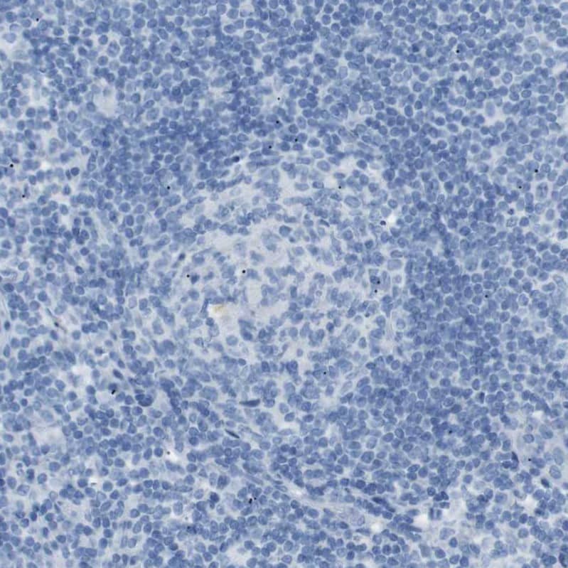 Staining of human lymph node shows no positivity in germinal center cells.