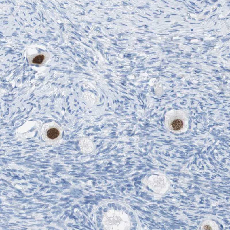 Staining of human ovary shows moderate nuclear positivity in follicle cells.
