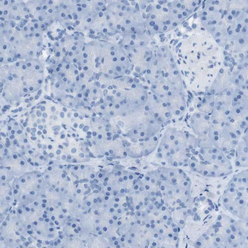 Staining of human pancreas shows no positivity in exocrine glandular cells.