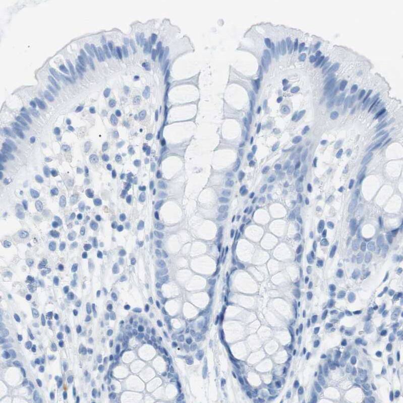 Staining of human colon shows no positivity in glandular cells.