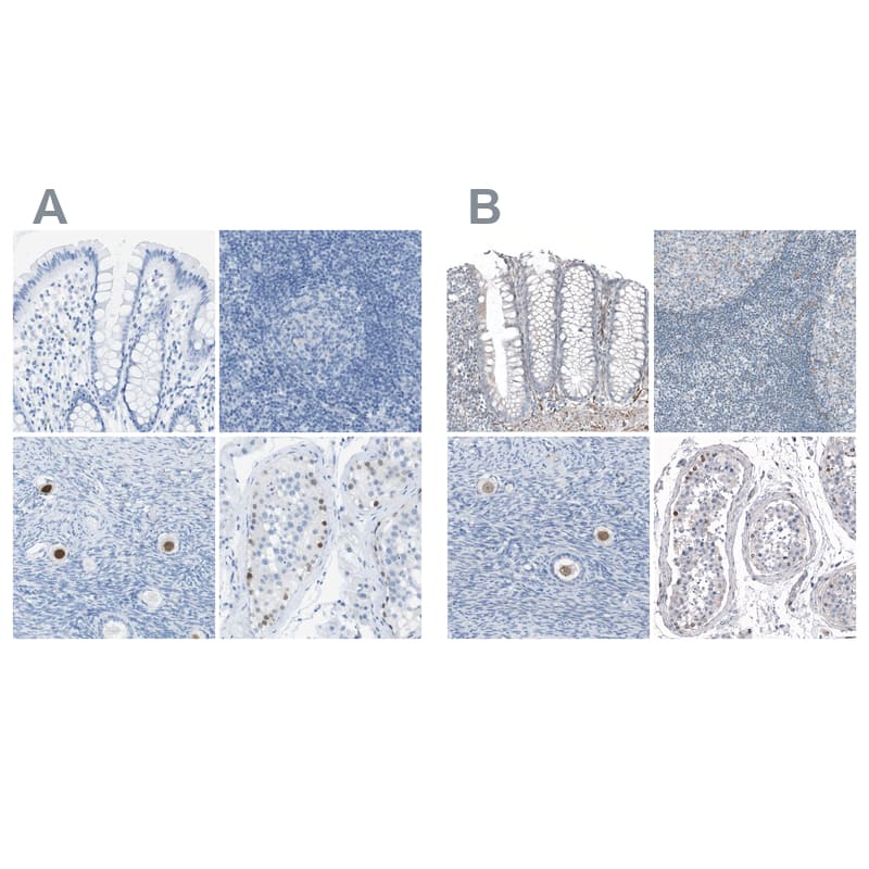 <b>Orthogonal Strategies Validation. </b>Staining of human colon, lymph node, ovary and testis HPA015291 (A) shows similar protein distribution across tissues to independent antibody HPA015791 (B).