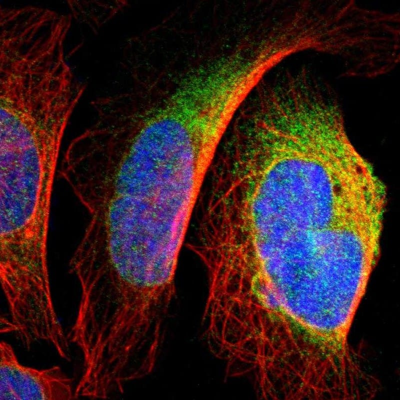 Staining of human cell line U-2 OS shows localization to endoplasmic reticulum.