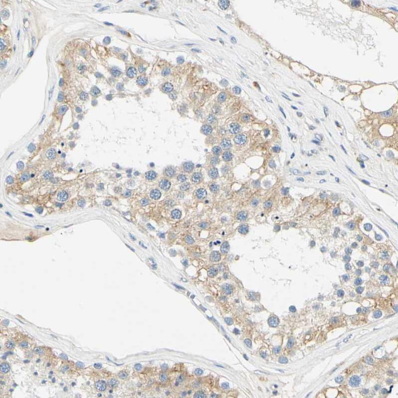 Immunohistochemistry-Paraffin DNAJB12 Antibody - BSA Free