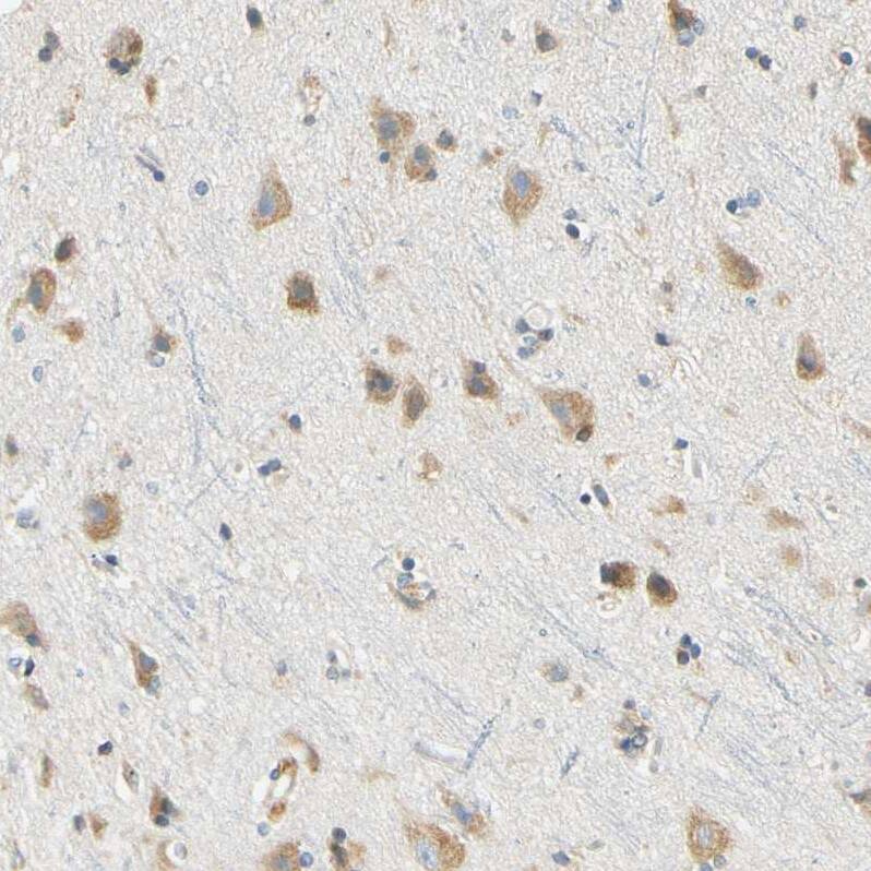 Staining of human cerebral cortex shows strong cytoplasmic positivity in neurons.