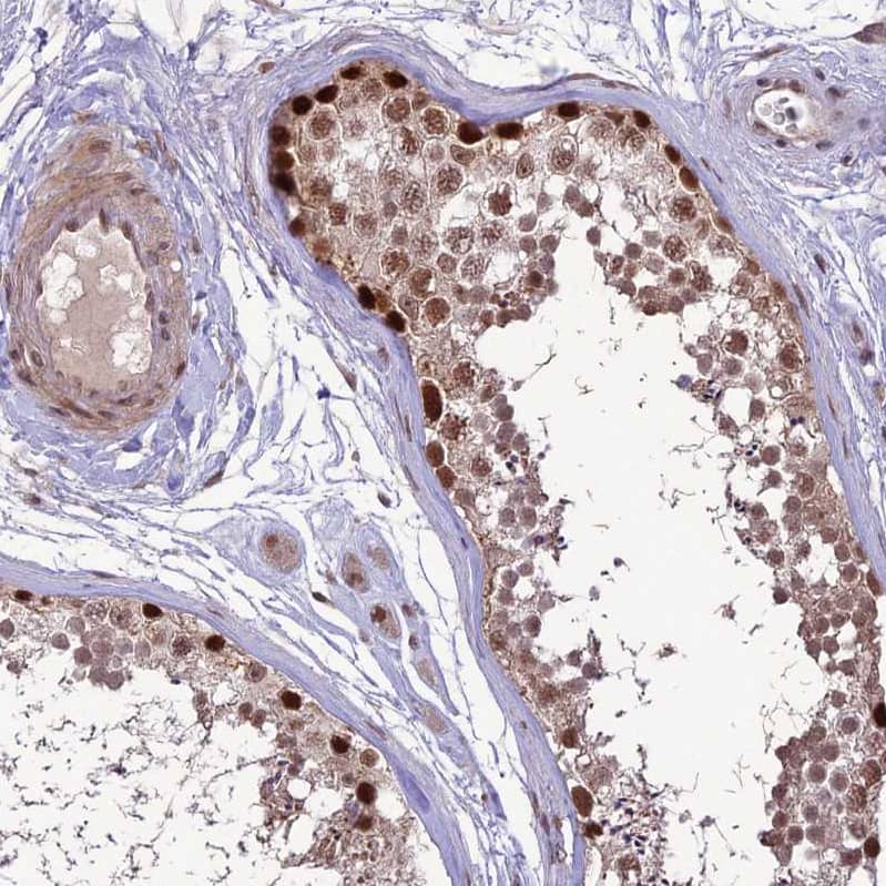 Immunohistochemistry-Paraffin DIS3 Antibody - BSA Free