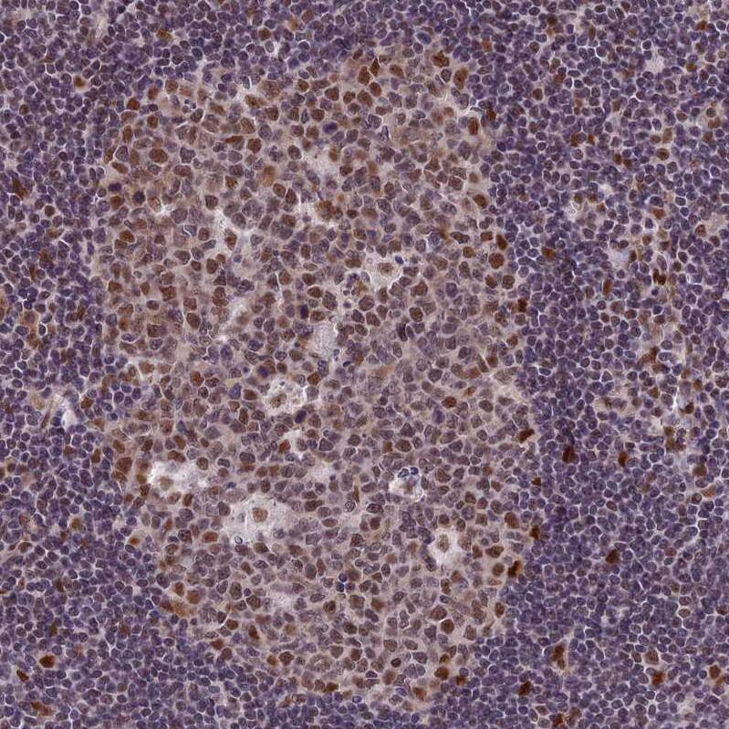 Immunohistochemistry-Paraffin DIS3 Antibody - BSA Free