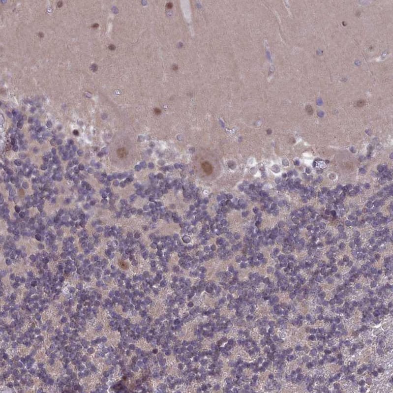 Immunohistochemistry-Paraffin DIS3 Antibody - BSA Free