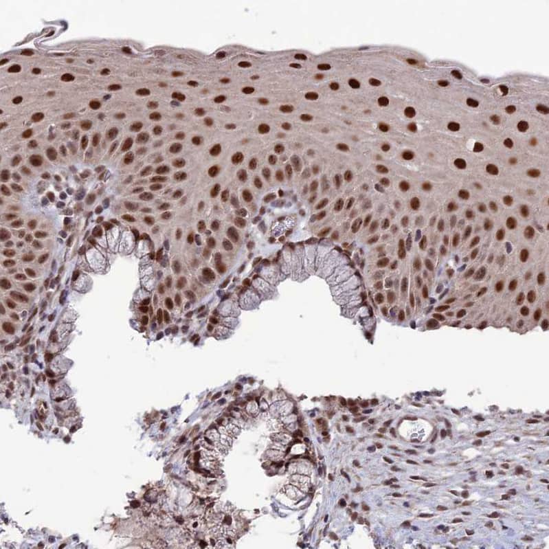 Immunohistochemistry-Paraffin DIS3 Antibody - BSA Free