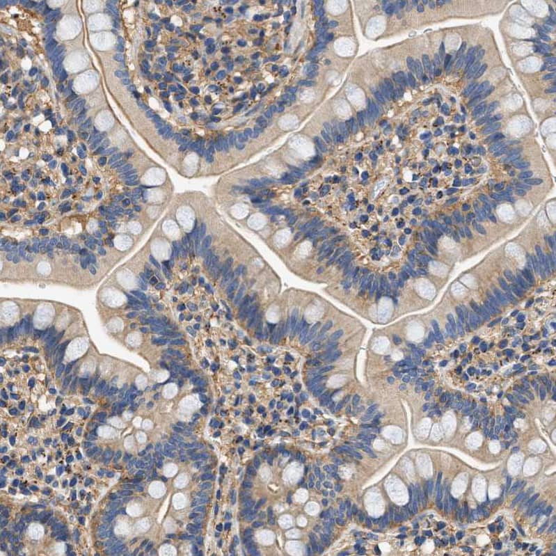 Staining of human small intestine shows weak cytoplasmic positivity in glandular cells.