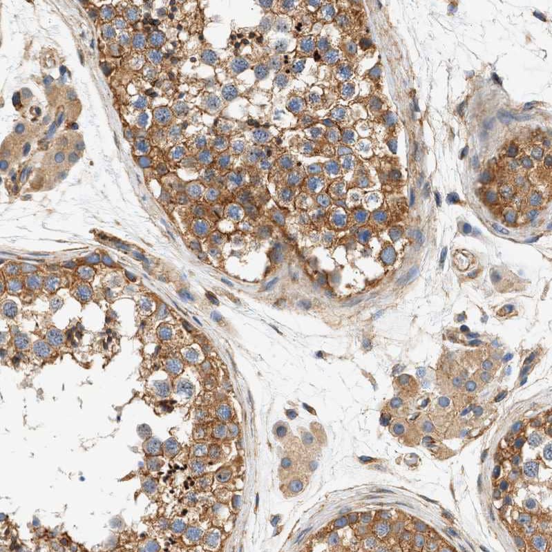 Staining of human testis shows strong membranous/cytoplasmic  positivity in cells in seminiferous ducts.