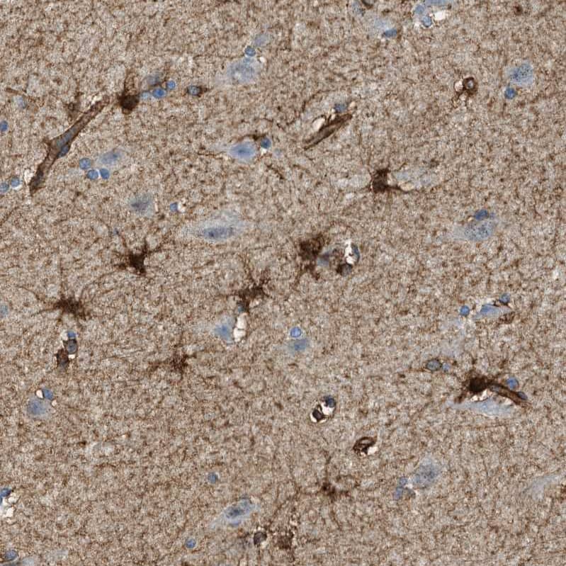 Staining of human cerebral cortex shows strong cytoplasmic positivity in glial cells.