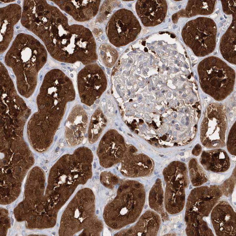 Staining of human kidney shows strong cytoplasmic positivity in cells in tubules.