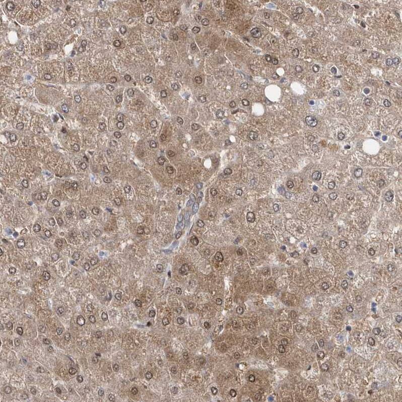 Staining of human liver shows moderate cytoplasmic positivity in hepatocytes.