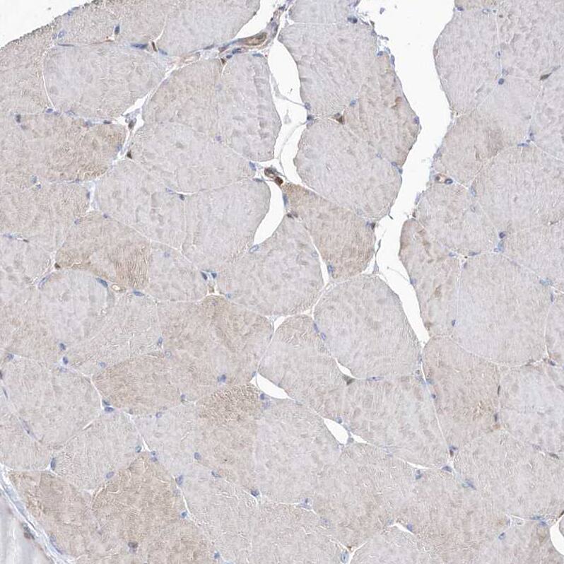 Staining of human skeletal muscle shows weak positivity in myocytes as expected.