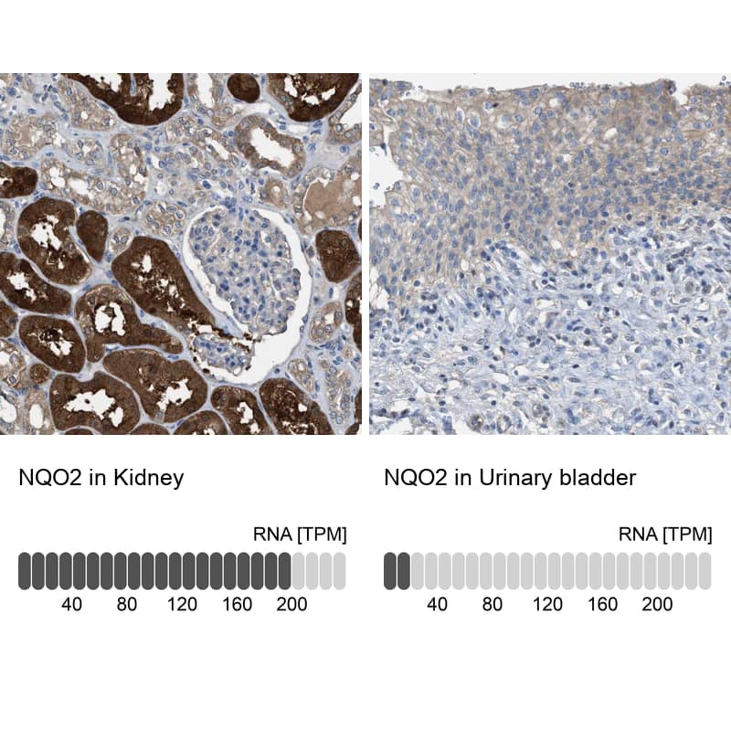 <b>Orthogonal Strategies Validation. </b>Analysis in human kidney and urinary bladder tissues. Corresponding RNA-seq data are presented for the same tissues.