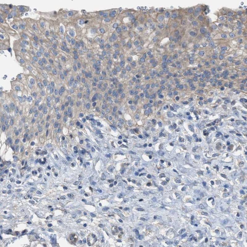 Staining of human urinary bladder shows low expression as expected.