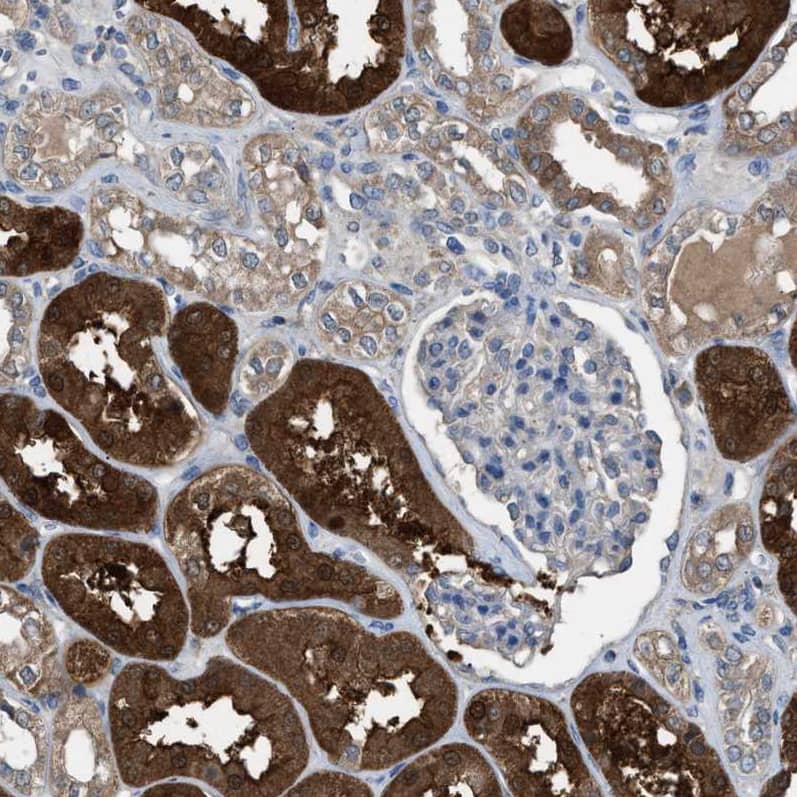 Staining of human kidney shows strong cytoplasmic positivity in cells in tubules.