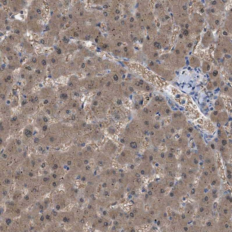 Staining of human liver shows moderate  cytoplasmic positivity in hepatocytes.