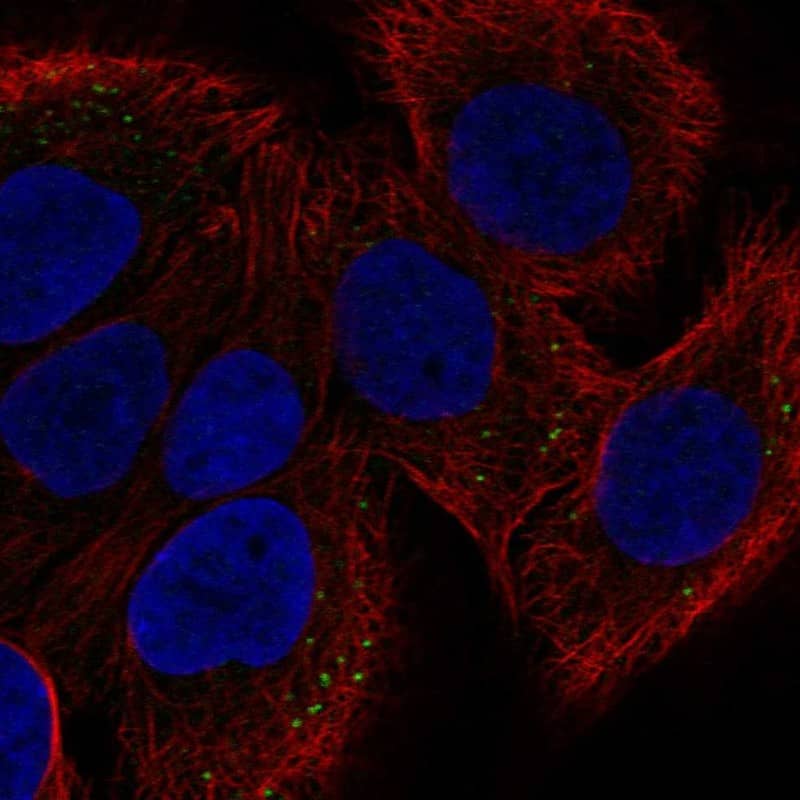 Staining of human cell line HaCaT shows localization to vesicles.