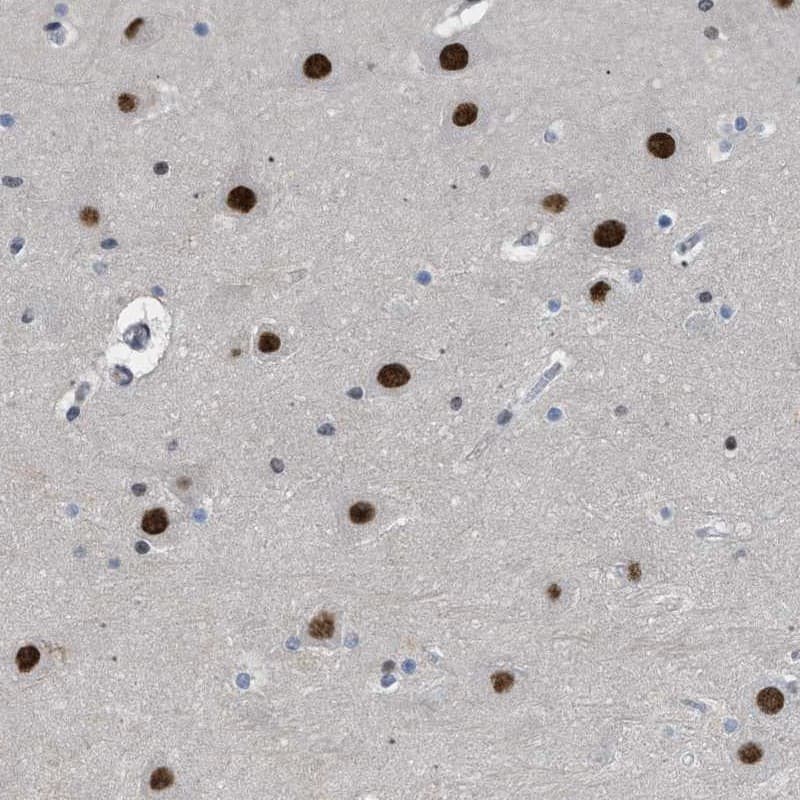 Staining of human hippocampus shows strong nuclear positivity in neuronal cells.
