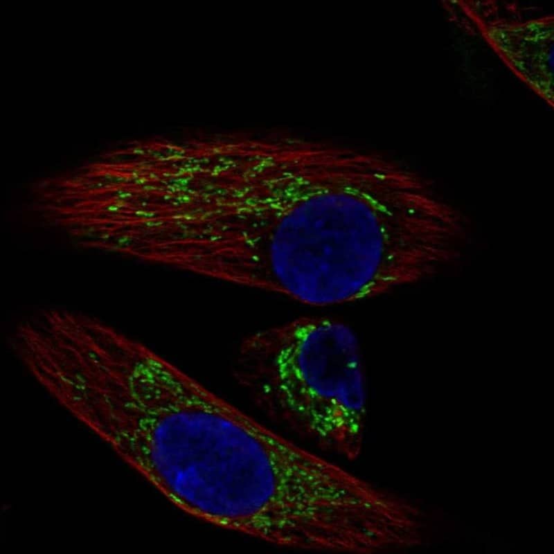 Staining of human cell line RPTEC TERT1 shows localization to mitochondria.