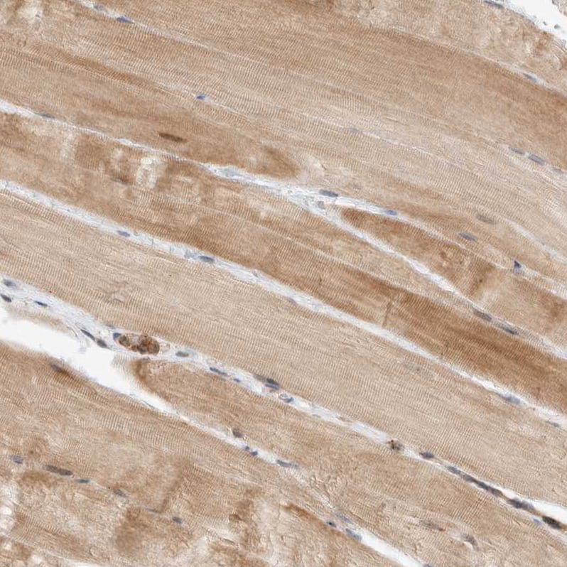 Staining of human skeletal muscle shows moderate cytoplasmic positivity in myocytes.
