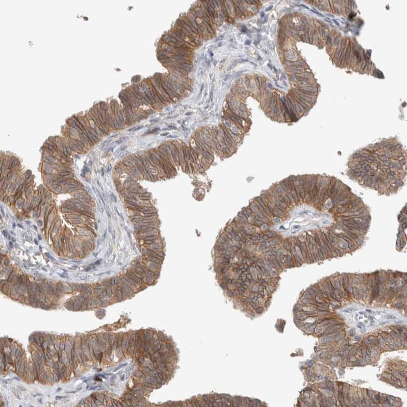 Staining of human fallopian tube shows moderate cytoplasmic positivity in glandular cells.