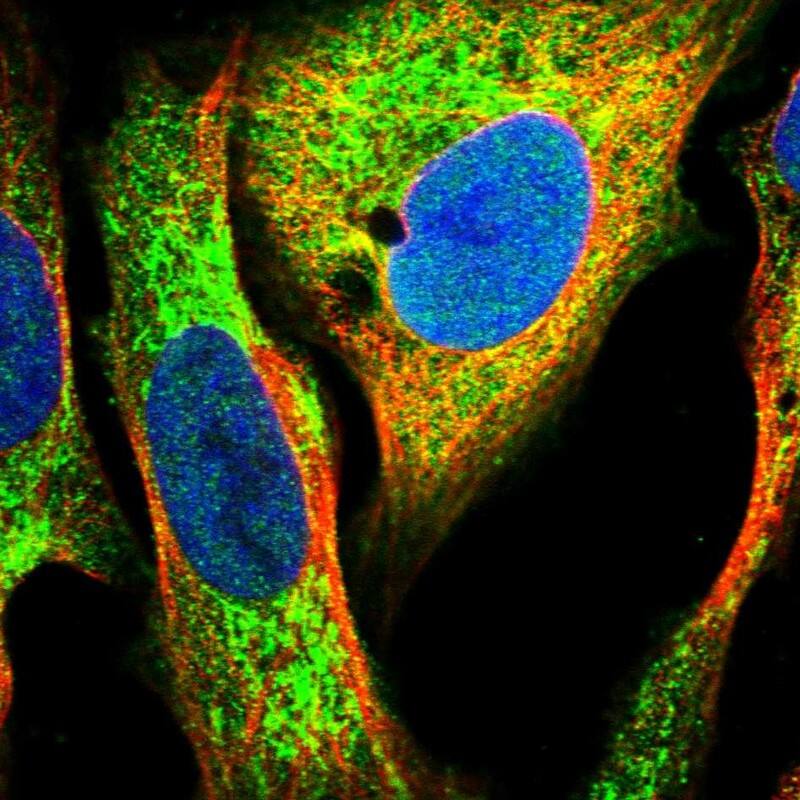 Staining of human cell line U-2 OS shows localization to cytosol & mitochondria.