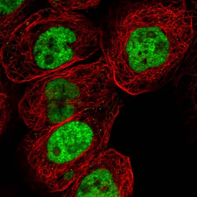 Staining of human cell line A-431 shows localization to nucleoplasm.