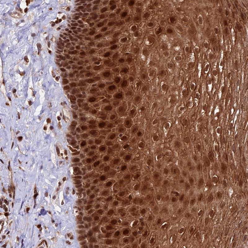 Staining of human esophagus shows strong cytoplasmic and nuclear positivity in squamous epithelial cells.