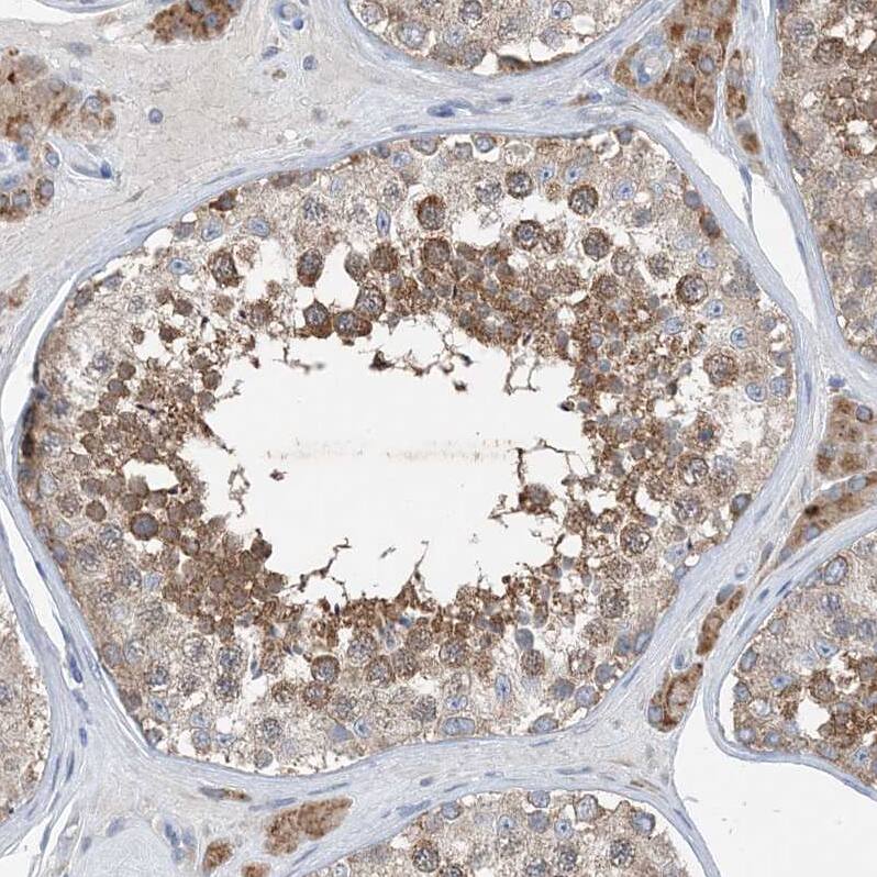 Staining of human testis shows moderate granular cytoplasmic positivity in seminiferous ducts.