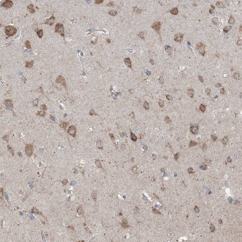 Staining of human cerebral cortex shows moderate granular cytoplasmic positivity in neurons.