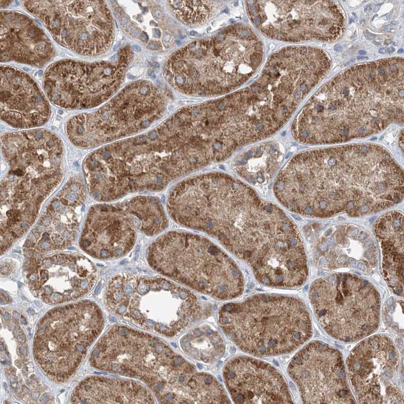 Staining of human kidney shows moderate granular cytoplasmic positivity in cells in tubules.