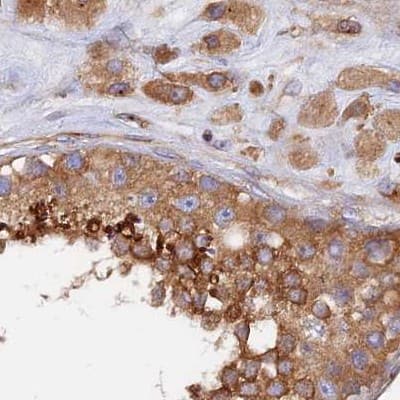 Staining of human testis.