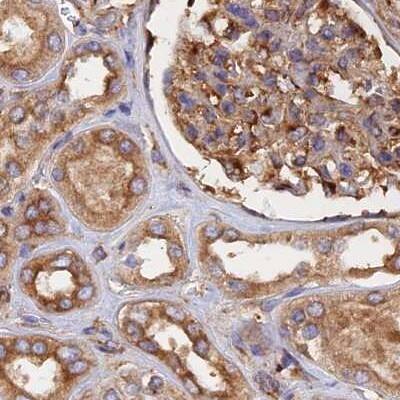 Staining of human kidney.