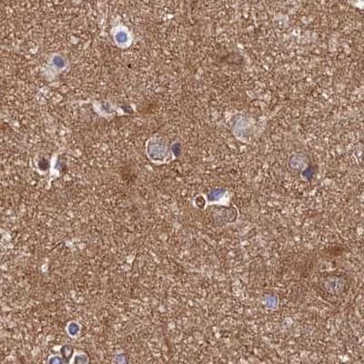 Staining of human cerebral cortex.