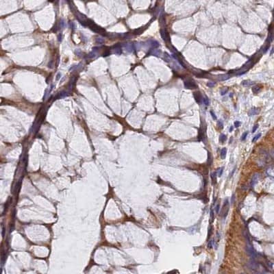 Staining of human colon.