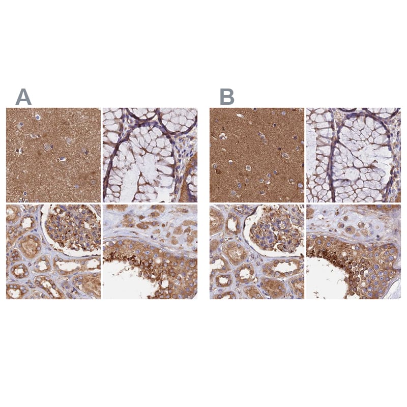 <b>Orthogonal Strategies Validation. </b>Staining of human cerebral cortex, colon, kidney and testis HPA039715 (A) shows similar protein distribution across tissues to independent antibody HPA040040 (B).