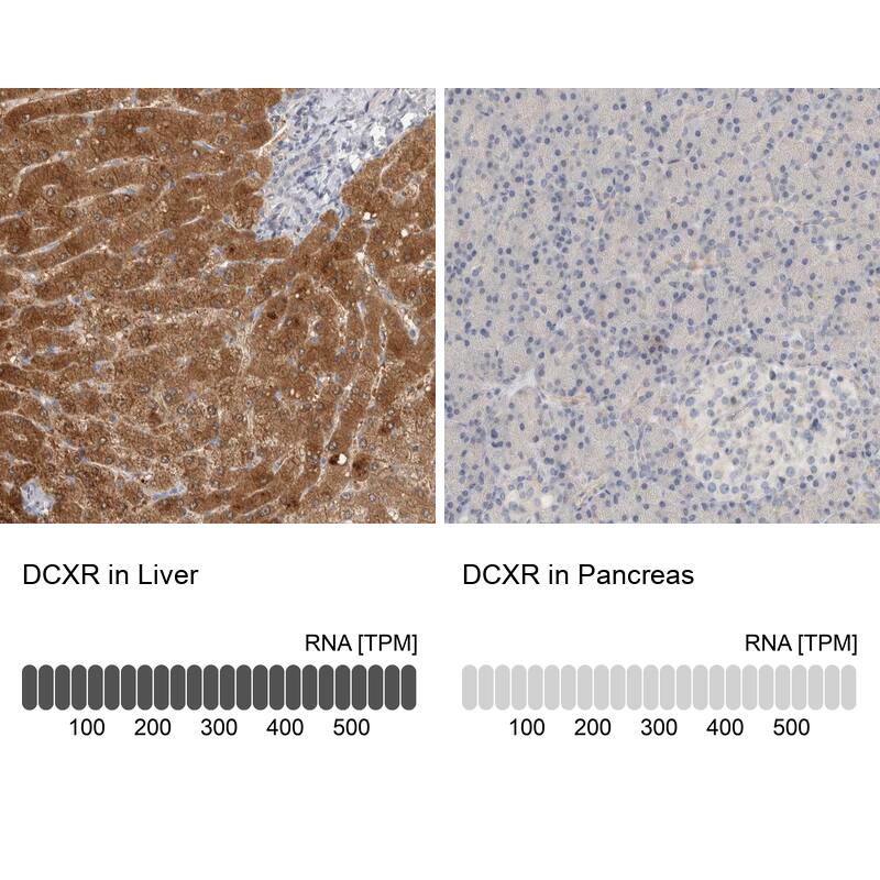 <b>Orthogonal Strategies Validation. </b>Analysis in human liver and pancreas tissues.