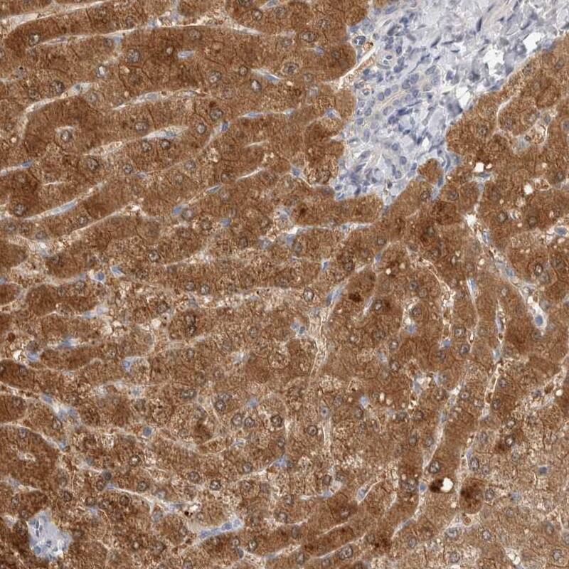 Staining of human liver shows high expression.