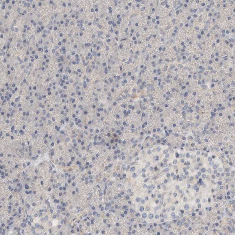 Staining of human pancreas shows low expression as expected.
