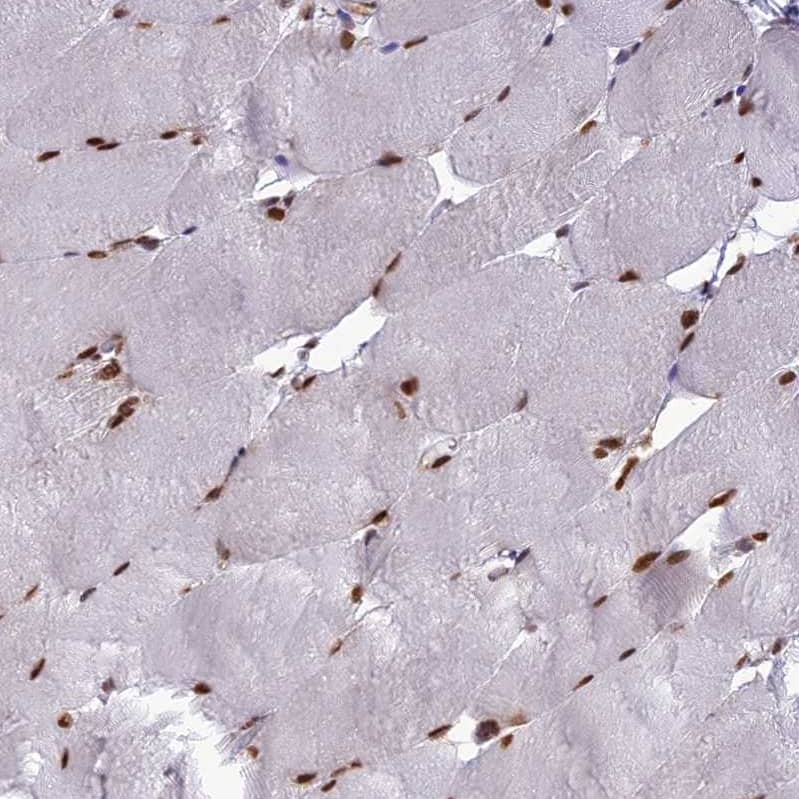 Staining of human skeletal muscle shows strong nuclear positivity in myocytes.