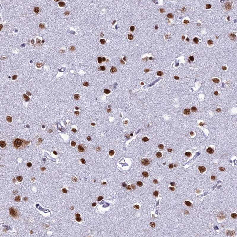 Staining of human cerebral cortex shows strong cytoplasmic/nuclear positivity in neurons and nuclear positivity in glial cells.