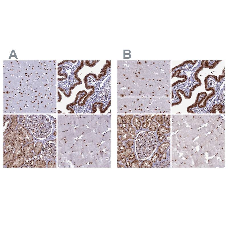 <b>Orthogonal Strategies Validation. </b>Staining of human cerebral cortex, fallopian tube, kidney and skeletal muscle HPA034503 (A) shows similar protein distribution across tissues to independent antibody HPA034502 (B).