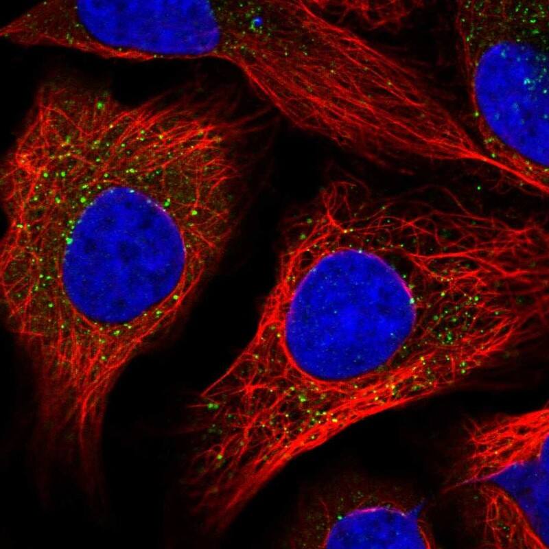 Staining of human cell line U-2 OS shows localization to peroxisomes.