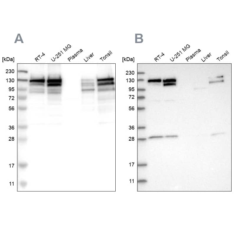 Western Blot DBC1/p30 Antibody