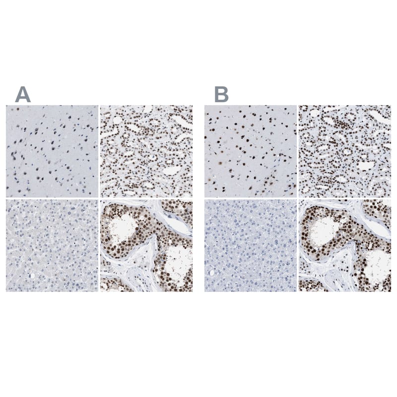 Immunohistochemistry-Paraffin DBC1/p30 Antibody