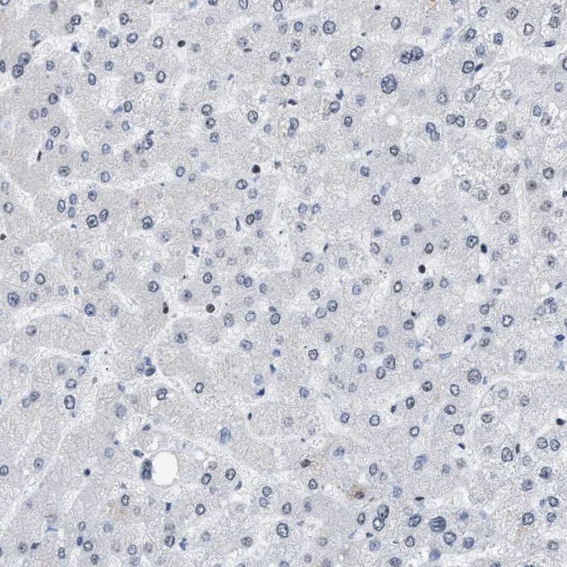 Immunohistochemistry-Paraffin DBC1/p30 Antibody