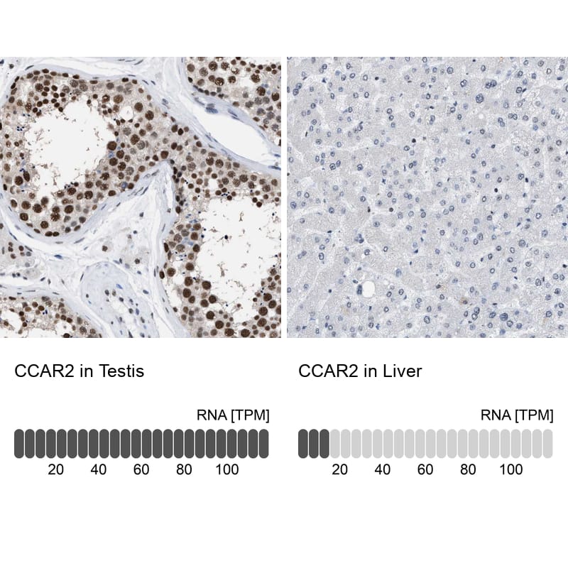 Immunohistochemistry-Paraffin DBC1/p30 Antibody
