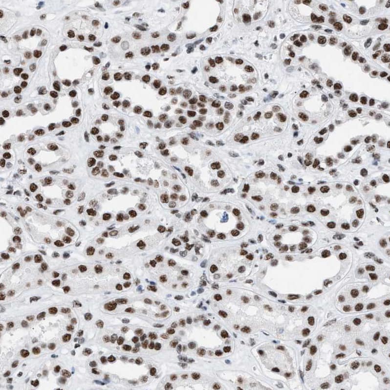 Immunohistochemistry-Paraffin DBC1/p30 Antibody